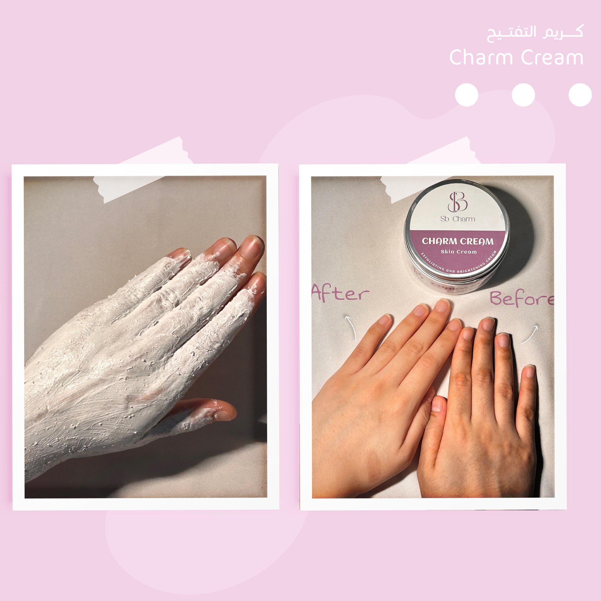 Charm Whitening Cream for Skin Brightening in UAE.