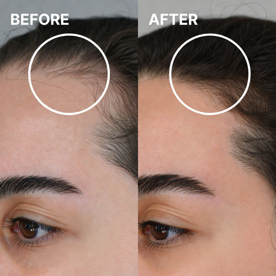 Charm Hair Oil – Stop Hair Fall & Grow Stronger Hair