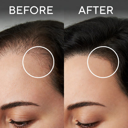 Charm Hair Oil – Stop Hair Fall & Grow Stronger Hair